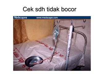Cek sdh tidak bocor 