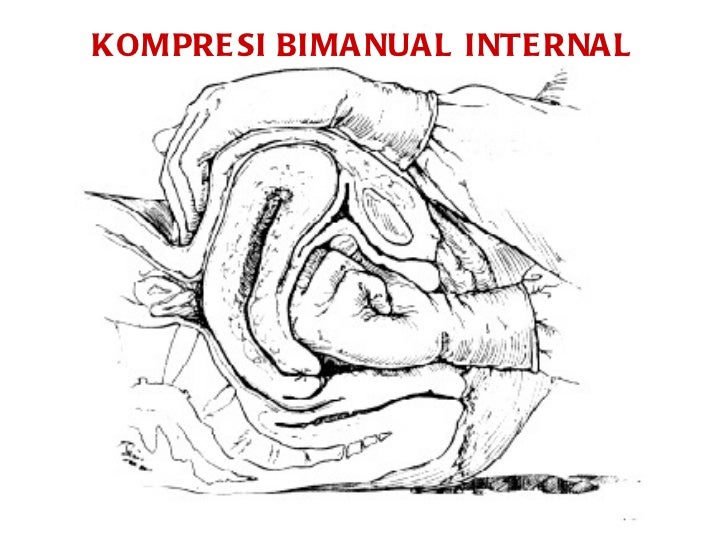 KOMPRESI BIMANUAL INTERNA EBOOK DOWNLOAD KOMPRESI BIMANUAL INTERNA EBOOK DOWNLOAD