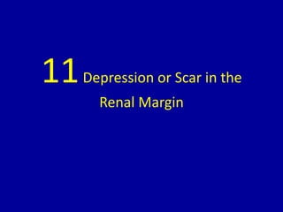 11Depression or Scar in the
Renal Margin
 