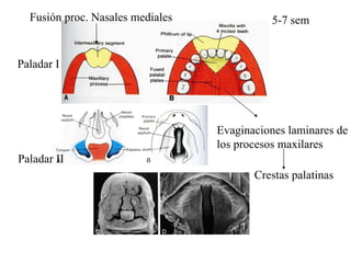 Paladar I Paladar II 5-7 sem Fusión proc. Nasales mediales Evaginaciones laminares de los procesos maxilares Crestas palatinas 