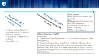 • He has on multiple CTs with air
space disease that did not fade
away all in between
investigations, could be mosaic
perfusion.
• Planned for PEA
NM Perfusion Scan Post-PEA
Impression:
1. Differential pulmonary perfusion is 29.6% to the left lung and 70.4% to
the right lung.
2. High probability lung scan for pulmonary embolism (PE present), age
indeterminate. Multiple bilateral unmatched perfusion defects are again
demonstrated, with significant interval improvement in perfusion to the
right lower and upper lobes and interval mild, globally reduced perfusion
to the left lung.
ECHO Post-PEA
Normal LV systolic function with
mild LVH
Moderate RV systolic dysfunction
Mild RA enlargement
Trivial MR, trivial PR, mild TR
RVSP = 43mmHg
TAPSE = 1.3cm (was 1.8)
 