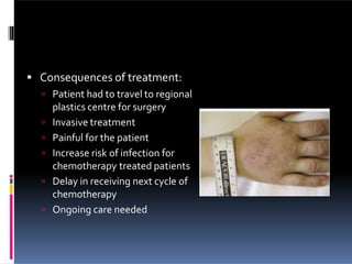  Consequences of treatment:
 Patient had to travel to regional
plastics centre for surgery
 Invasive treatment
 Painful for the patient
 Increase risk of infection for
chemotherapy treated patients
 Delay in receiving next cycle of
chemotherapy
 Ongoing care needed
 