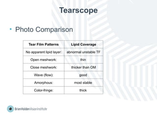 Tearscope
• Photo Comparison
Tear Film Patterns Lipid Coverage
No apparent lipid layer: abnormal unstable TF
Open meshwork: thin
Close meshwork: thicker than OM
Wave (flow): good
Amorphous: most stable
Color-fringe: thick
 