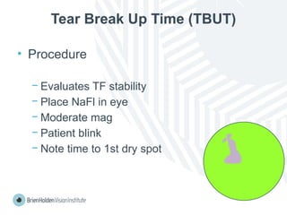 Tear Break Up Time (TBUT)
• Procedure
− Evaluates TF stability
− Place NaFl in eye
− Moderate mag
− Patient blink
− Note time to 1st dry spot
 