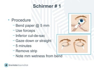 Schirmer # 1
• Procedure
− Bend paper @ 5 mm
− Use forceps
− Inferior cul-de-sac
− Gaze down or straight
− 5 minutes
− Remove strip
− Note mm wetness from bend
 