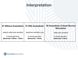 Interpretation
#1 Without Anaesthetic #1 With Anaesthetic #2 Anaesthetic & Nasal Mucosa
Stimulation
basal & reflex tear secretion basal tear secretion only reflex tear secretion
5 minute test time 5 minute test time 2 minute test time
Abnormal <10mm - 15mm Abnormal < 10mm Abnormal <15mm
 