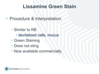 Lissamine Green Stain
• Procedure & Interpretation
− Similar to RB
• devitalized cells, mucus
− Green Staining
− Does not sting
− Now available commercially
 