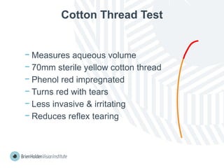 Cotton Thread Test
− Measures aqueous volume
− 70mm sterile yellow cotton thread
− Phenol red impregnated
− Turns red with tears
− Less invasive & irritating
− Reduces reflex tearing
 
