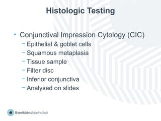 Histologic Testing
• Conjunctival Impression Cytology (CIC)
− Epithelial & goblet cells
− Squamous metaplasia
− Tissue sample
− Filter disc
− Inferior conjunctiva
− Analysed on slides
 