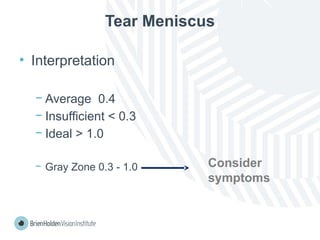 Tear Meniscus
• Interpretation
− Average 0.4
− Insufficient < 0.3
− Ideal > 1.0
− Gray Zone 0.3 - 1.0 Consider
symptoms
 