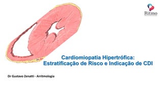 Cardiomiopatia Hipertrófica:
Estratificação de Risco e Indicação de CDI
Dr Gustavo Zenatti - Arritmologia
 
