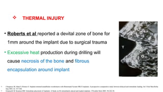  THERMAL INJURY
• Roberts et al reported a devital zone of bone for
1mm around the implant due to surgical trauma
• Excessive heat production during drilling will
cause necrosis of the bone and fibrous
encapsulation around implant
• Chiapasco M, Abati S, Romeo E: Implant-retained mandibular overdentures with Branemark System MK II implants. A prospective comparative study between delayed and immediate loading. Int J Oral Maxillofac
Imp 2001;16: 537-546.
• Emanuelli M, Knutsen BM: Immediate placement of implants: A Study on 86 immediately placed and loaded implants. J Prosthet Dent 2005; 94:242-58.
 