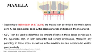 MAXILLA
• According to Bedrossian et al. [2008], the maxilla can be divided into three zones:
zone 1, the premaxilla; zone 2, the premolar area; and zone 3, the molar area
• CBCT can be used to determine the amount of bone in these zones as well as in
the zygomatic arch, in both horizontal and vertical dimensions. Moreover, any
pathology in these areas, as well as in the maxillary sinuses, needs to be verified
preoperatively.
• Misch C. Contemporary Implant Dentistry. Implant Dentistry. 1999;8(1):90.
• Chong W. Immediate Loading. Implant Dentistry. 2002;11(4):315-316
 