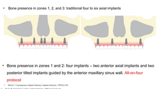 • Bone presence in zones 1, 2, and 3: traditional four to six axial implants
• Bone presence in zones 1 and 2: four implants – two anterior axial implants and two
posterior tilted implants guided by the anterior maxillary sinus wall. All-on-four
protocol
• Misch C. Contemporary Implant Dentistry. Implant Dentistry. 1999;8(1):90.
 