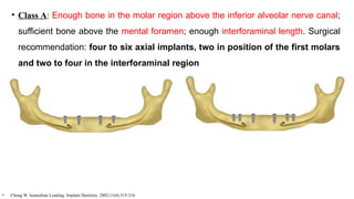• Class A: Enough bone in the molar region above the inferior alveolar nerve canal;
sufficient bone above the mental foramen; enough interforaminal length. Surgical
recommendation: four to six axial implants, two in position of the first molars
and two to four in the interforaminal region
• Chong W. Immediate Loading. Implant Dentistry. 2002;11(4):315-316
 