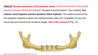 Class B: No bone presence in the posterior areas; sufficient bone above the mental
foramen; enough interforaminal length. Surgical recommendation: four implants, two
anterior axial implants and two posterior tilted implants. The entrance point of the
two posterior implants is above the mental foramen with a 30° angulation to save the
nerve loop and reduced the cantilever length. All-on-four protocol (Fig. 14).
• Chong W. Immediate Loading. Implant Dentistry. 2002;11(4):315-316
 