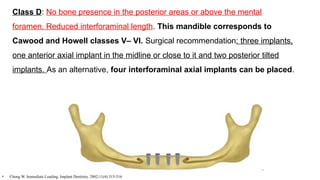 Class D: No bone presence in the posterior areas or above the mental
foramen. Reduced interforaminal length. This mandible corresponds to
Cawood and Howell classes V– VI. Surgical recommendation: three implants,
one anterior axial implant in the midline or close to it and two posterior tilted
implants. As an alternative, four interforaminal axial implants can be placed.
• Chong W. Immediate Loading. Implant Dentistry. 2002;11(4):315-316
 