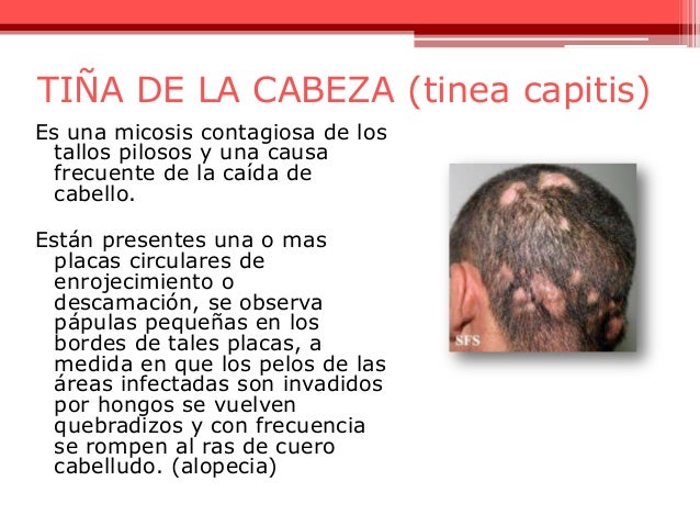 La máscara para los cabellos con la tintura del pimiento rojo y la vitamina