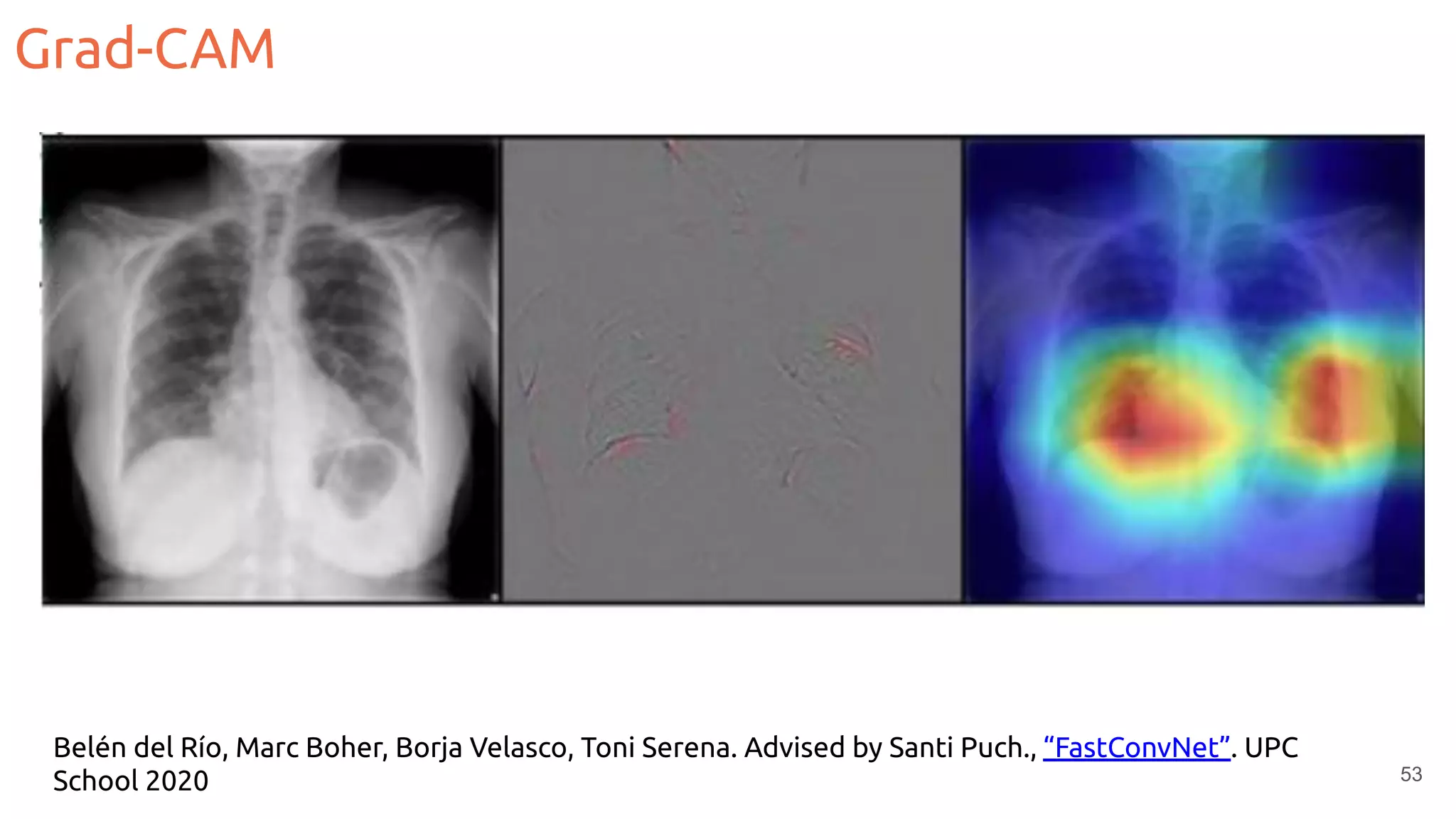 Grad-CAM
53
Belén del Río, Marc Boher, Borja Velasco, Toni Serena. Advised by Santi Puch., “FastConvNet”. UPC
School 2020
 