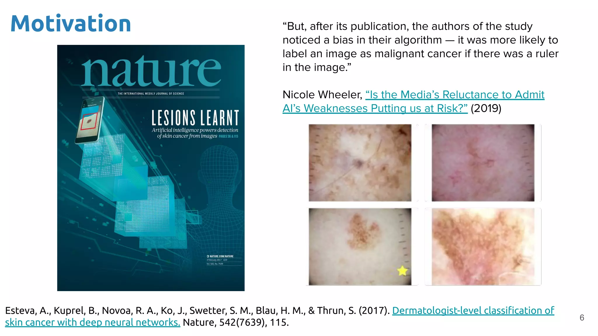 Motivation
6
Esteva, A., Kuprel, B., Novoa, R. A., Ko, J., Swetter, S. M., Blau, H. M., & Thrun, S. (2017). Dermatologist-level classiﬁcation of
skin cancer with deep neural networks. Nature, 542(7639), 115.
 