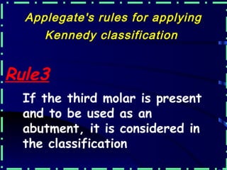Applegate's Rules.pdf introduction to removable partial denture | PPT
