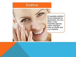 Estética


           El resultado estético
           de los implantes es
           asombroso. Es muy
           difícil, o casi
           imposible algunas
           veces, distinguir
           entre un diente real
           y un implante.
 