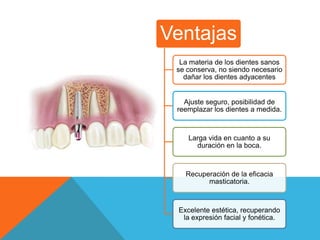 Ventajas
  La materia de los dientes sanos
 se conserva, no siendo necesario
   dañar los dientes adyacentes


   Ajuste seguro, posibilidad de
 reemplazar los dientes a medida.



    Larga vida en cuanto a su
      duración en la boca.



   Recuperación de la eficacia
         masticatoria.



 Excelente estética, recuperando
  la expresión facial y fonética.
 