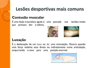 Lesões desportivas mais comuns
Contusão muscular
É uma lesão traumática aguda é uma pancada nos tecidos moles
que provoca dor e edema.
Luxação
É a deslocação de um osso ou de uma articulação. Ocorre quando
uma força violenta atua direta ou indiretamente numa articulação,
empurrando o osso para uma posição anormal.
 