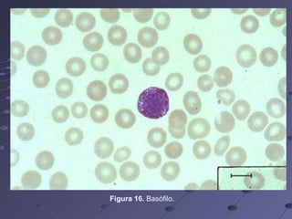 Figura 16.  Basófilo. 