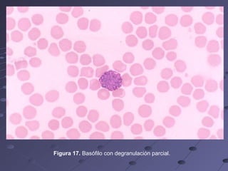 Figura 17.  Basófilo con degranulación parcial.   
