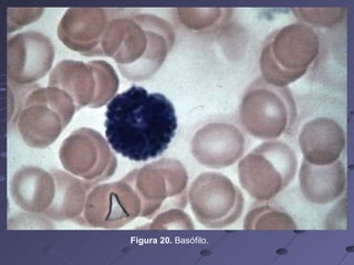 Figura 20.  Basófilo. 