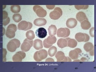 Figura 24.  Linfocito. 