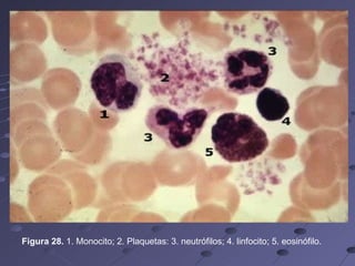 Figura 28.  1. Monocito; 2. Plaquetas: 3. neutrófilos; 4. linfocito; 5. eosinófilo.  