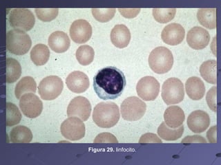 Figura 29.  linfocito. 