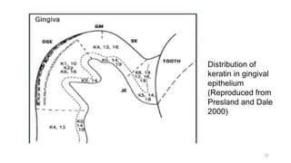 27
Distribution of
keratin in gingival
epithelium
(Reproduced from
Presland and Dale
2000)
 