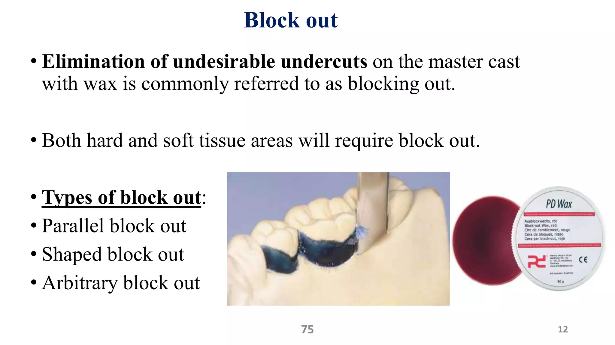 Block out
• Elimination of undesirable undercuts on the master cast
with wax is commonly referred to as blocking out.
• Both hard and soft tissue areas will require block out.
• Types of block out:
• Parallel block out
• Shaped block out
• Arbitrary block out
1275
 