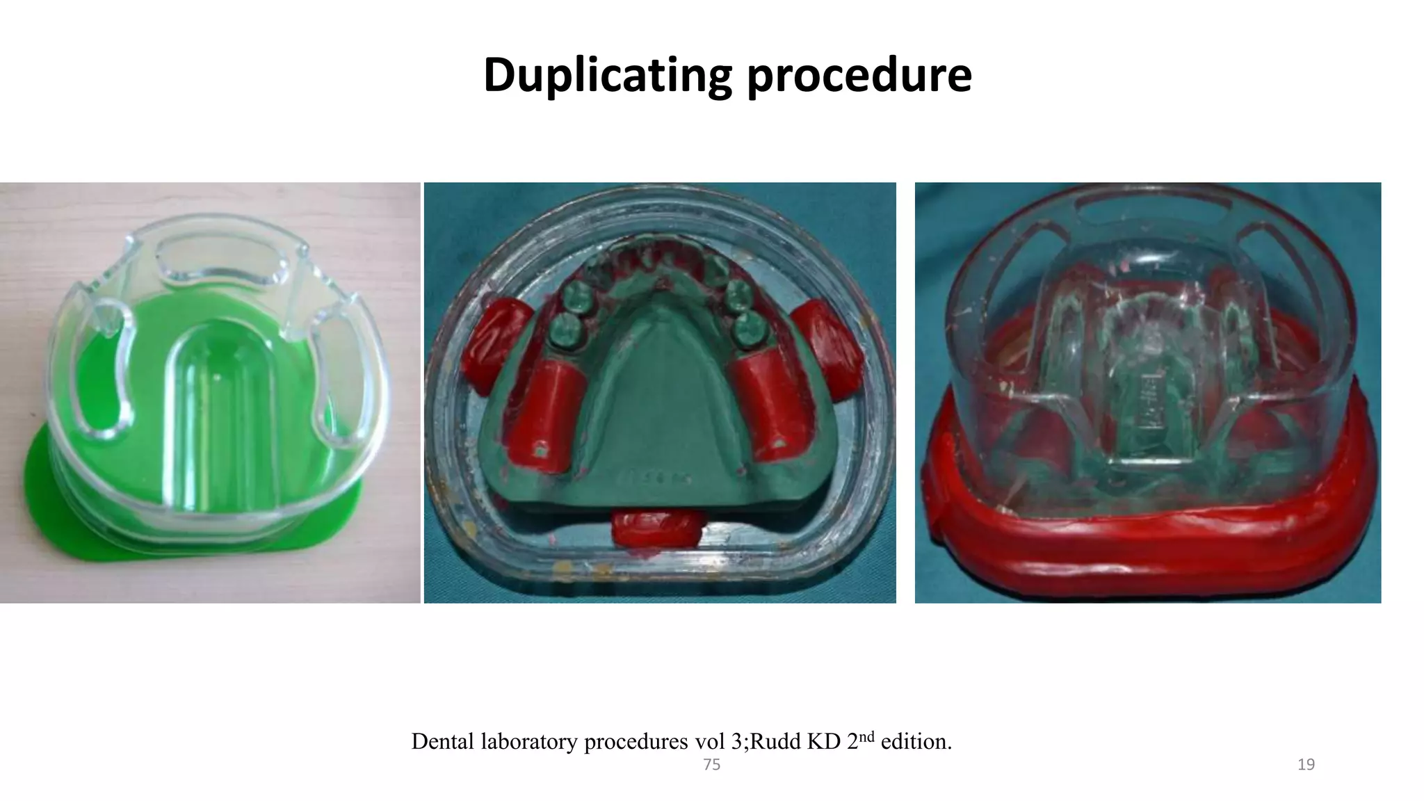 1975
Dental laboratory procedures vol 3;Rudd KD 2nd edition.
Duplicating procedure
 