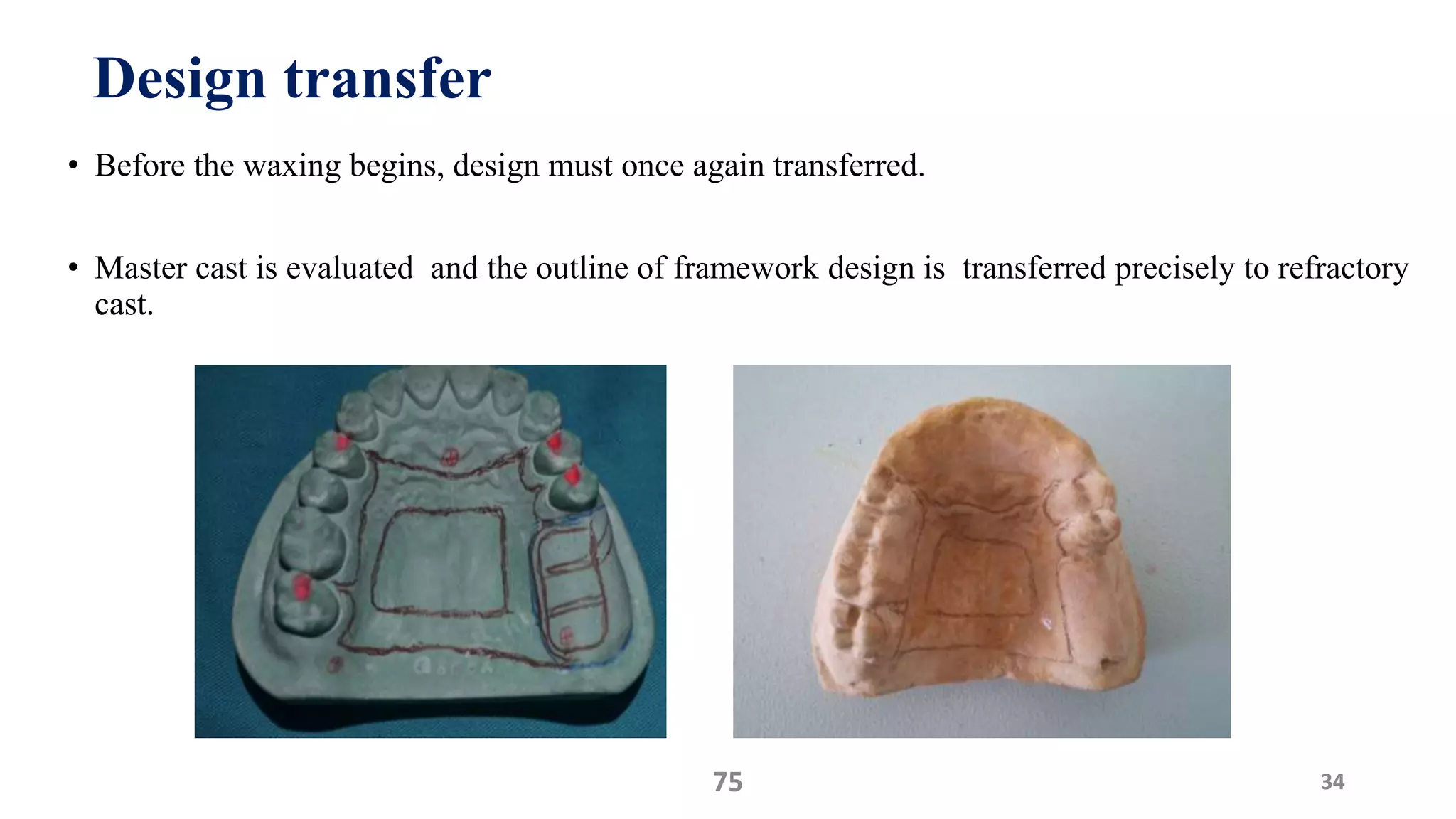 • Before the waxing begins, design must once again transferred.
• Master cast is evaluated and the outline of framework design is transferred precisely to refractory
cast.
3475
Design transfer
 
