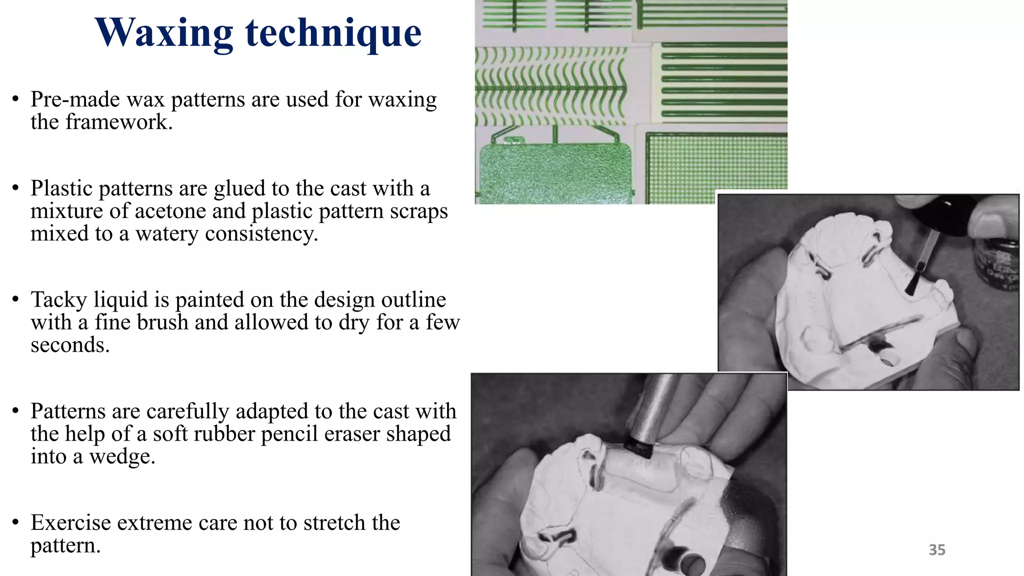 Waxing technique
• Pre-made wax patterns are used for waxing
the framework.
• Plastic patterns are glued to the cast with a
mixture of acetone and plastic pattern scraps
mixed to a watery consistency.
• Tacky liquid is painted on the design outline
with a fine brush and allowed to dry for a few
seconds.
• Patterns are carefully adapted to the cast with
the help of a soft rubber pencil eraser shaped
into a wedge.
• Exercise extreme care not to stretch the
pattern. 3575
 
