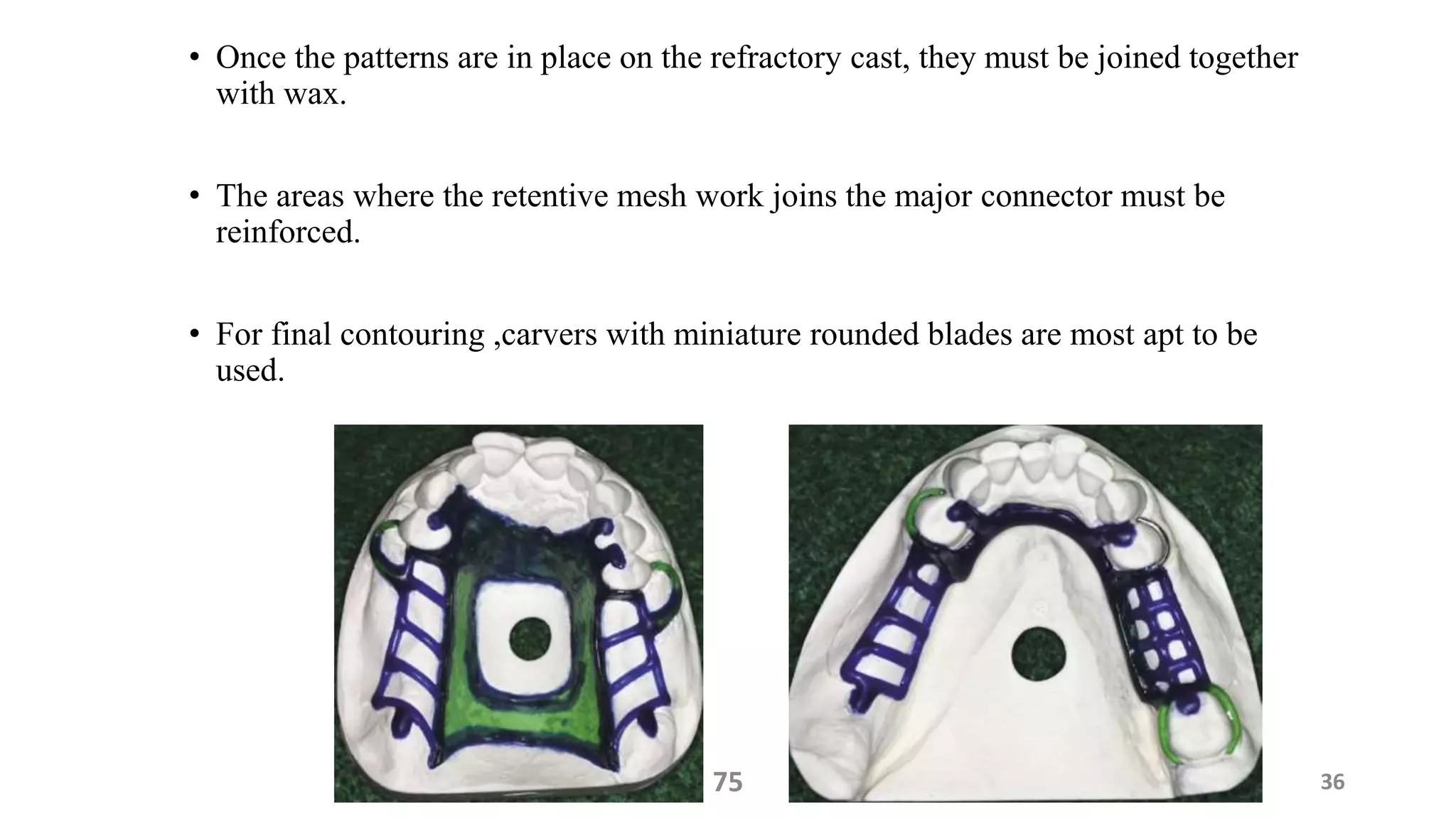 • Once the patterns are in place on the refractory cast, they must be joined together
with wax.
• The areas where the retentive mesh work joins the major connector must be
reinforced.
• For final contouring ,carvers with miniature rounded blades are most apt to be
used.
3675
 