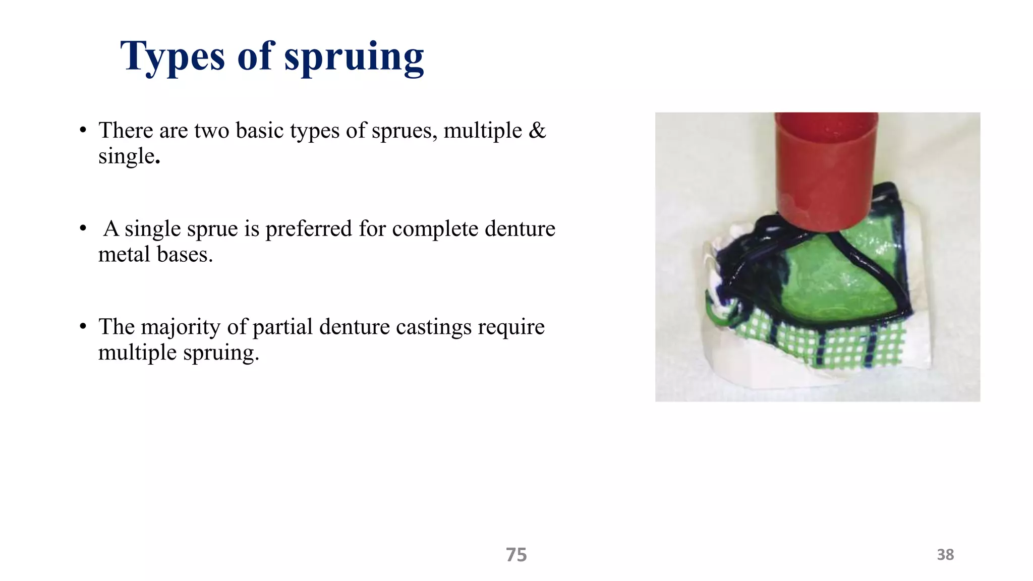 Types of spruing
• There are two basic types of sprues, multiple &
single.
• A single sprue is preferred for complete denture
metal bases.
• The majority of partial denture castings require
multiple spruing.
3875
 