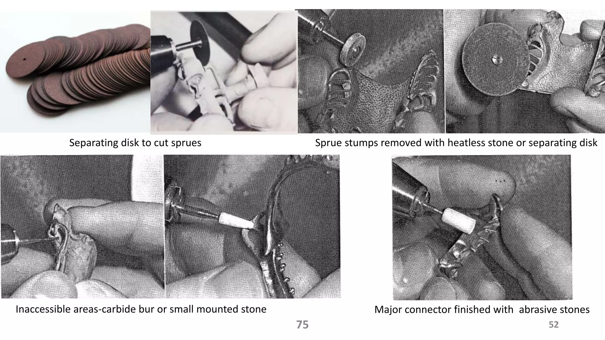 Sprue stumps removed with heatless stone or separating disk
Inaccessible areas-carbide bur or small mounted stone Major connector finished with abrasive stones
5275
Separating disk to cut sprues
 