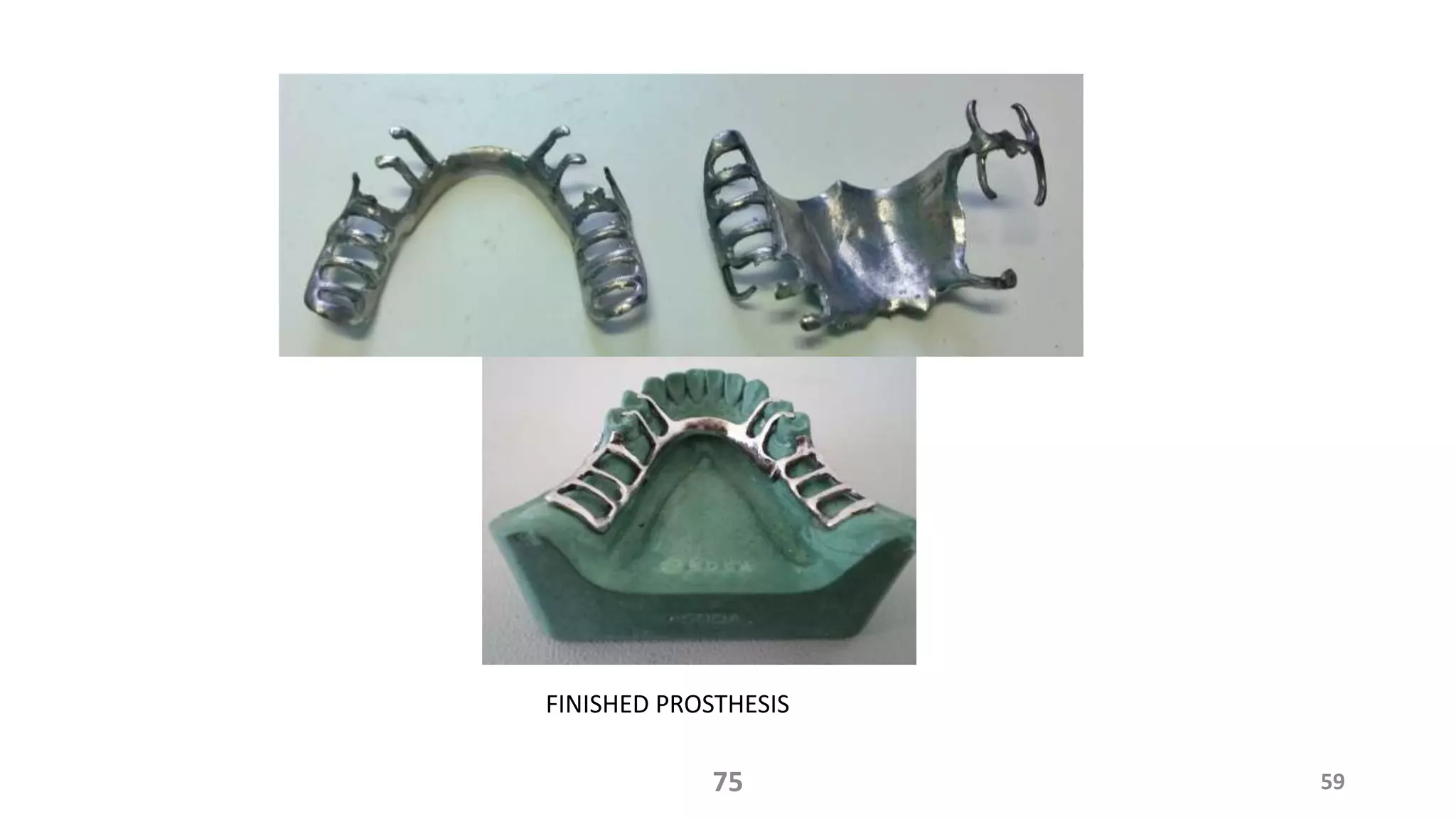 5975
FINISHED PROSTHESIS
 