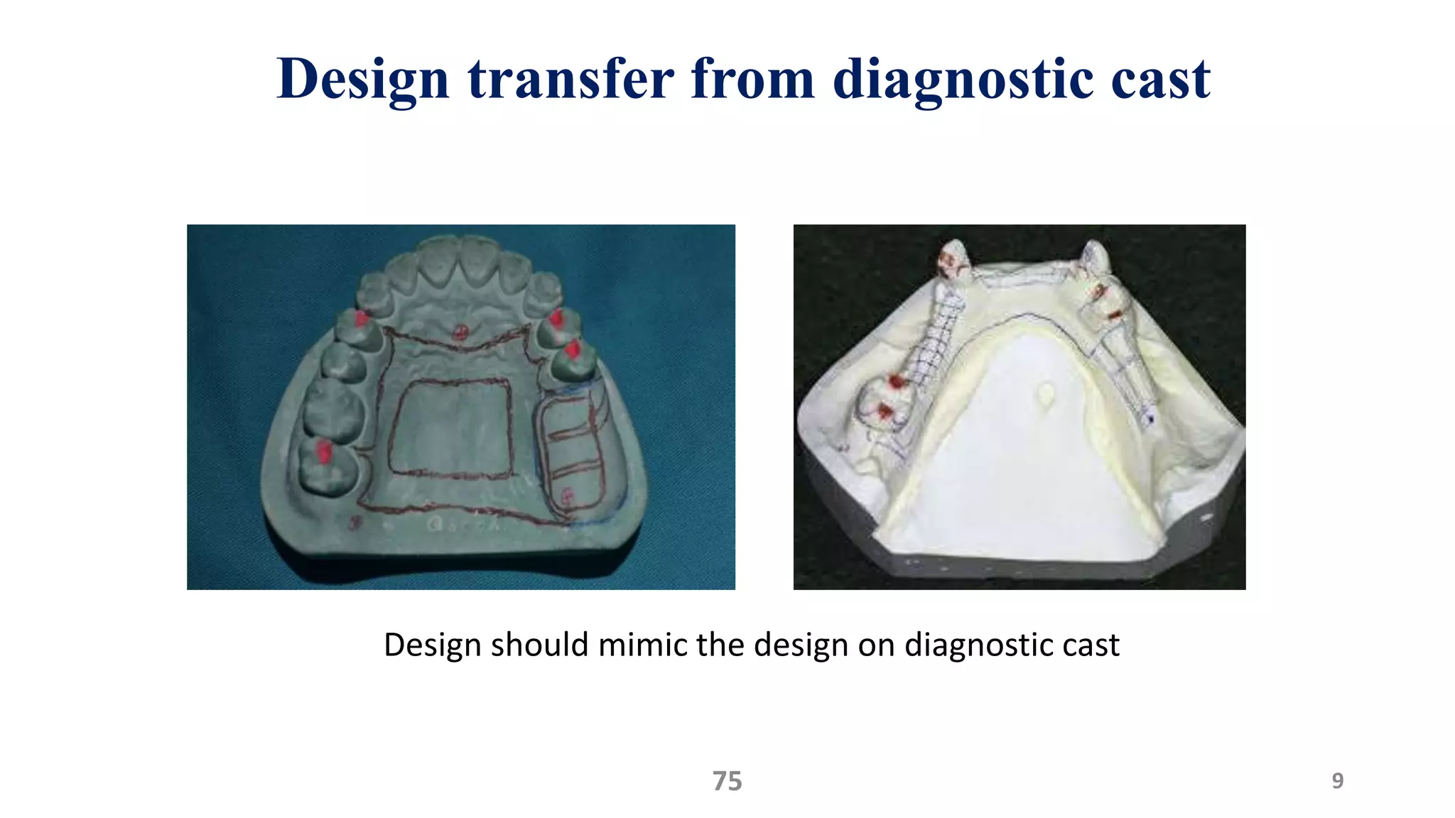 Design transfer from diagnostic cast
975
Design should mimic the design on diagnostic cast
 