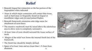 Laboratory procedures in rpd- Kelly | PPTX