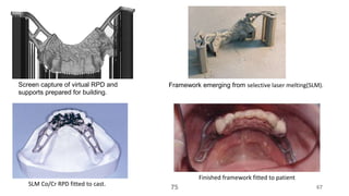 Laboratory procedures in rpd- Kelly | PPTX