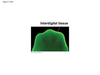 Figure 11.22a
Interdigital tissue
 