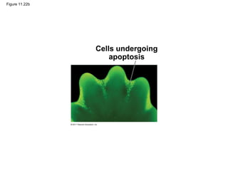 Figure 11.22b
Cells undergoing
apoptosis
 