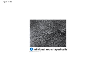 Figure 11.3a
Individual rod-shaped cells1
 