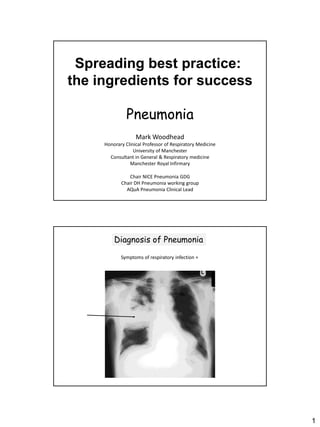 Spreading best practice:
the ingredients for success

               Pneumonia
                   Mark Woodhead
     Honorary Clinical Professor of Respiratory Medicine
                  University of Manchester
       Consultant in General & Respiratory medicine
                Manchester Royal Infirmary

                Chair NICE Pneumonia GDG
            Chair DH Pneumonia working group
              AQuA Pneumonia Clinical Lead




         Diagnosis of Pneumonia
            Symptoms of respiratory infection +




                                                           1
 